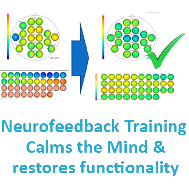 Neurofeedback Training calms the mind and restores functionality
