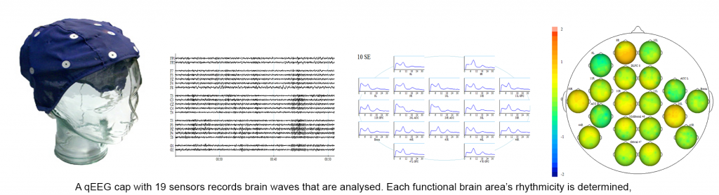 How does it work? - Neurofeedback London - Brighton - Manchester