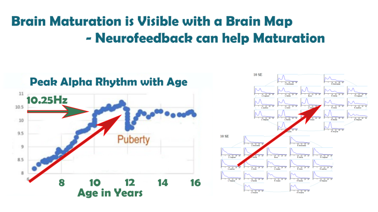Brain Maturation as measured by posterior dominant, or peak alpha rhythm, can be seen with a brain map, and maturation assisted with neurofeedback