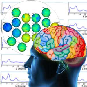Kaiser Neuromap based Personalised Brain Training using neurofeedback and brain maps including Brodmann areas and spectral plots
