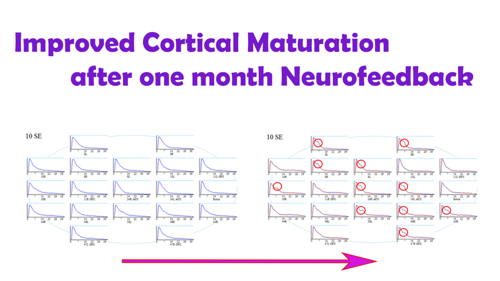 Cortical maturation measured with spectral plots is improved with neurofeedback training