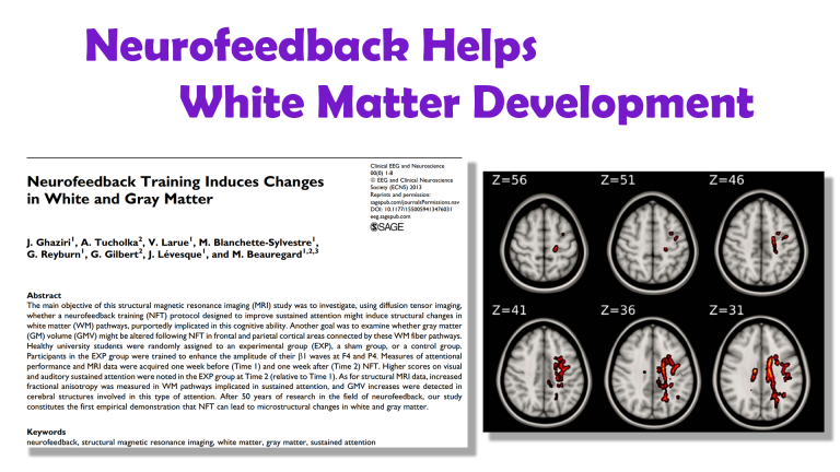 Ghaziri2013 Study showing neurofeedback training helps develop white matter tracts