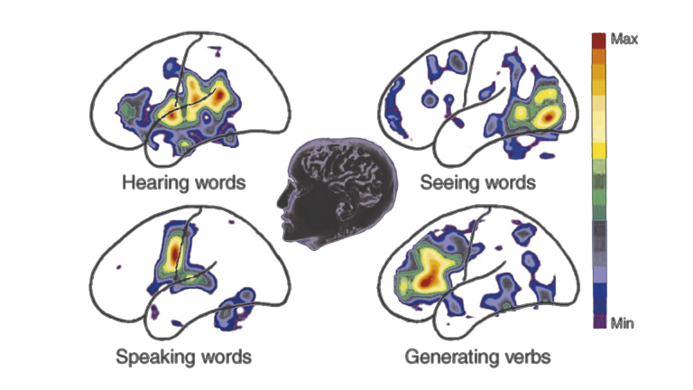 PET activation of the brain in different word tasks, showing differential activation of various language and speech networks, which we can train with neurofeedback
