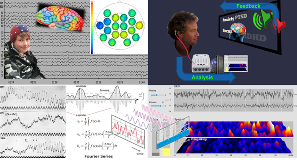 Neurofeedback process explained from qEEG brain map to real time analysis via cygnet software to produce neurofeedback for various pathologies