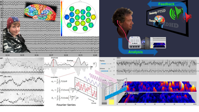Neurofeedback process explained from qEEG brain map to real time analysis via cygnet software to produce neurofeedback for various pathologies