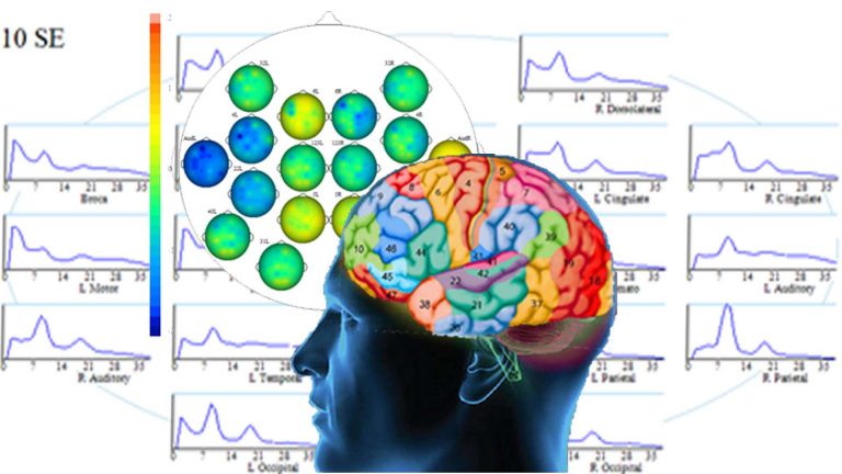 qEEG brain maps allow for a personalised approach to neurofeedback training that is effective for many mental health issues in a non-invasive, evidence-based and enjoyable manner by Daniel Webster