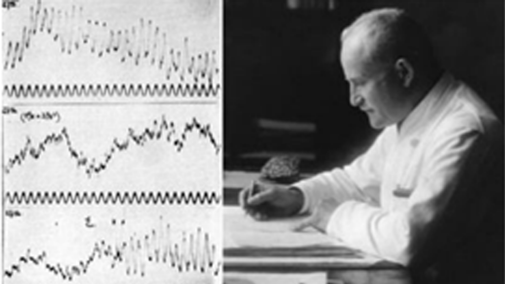 EEG signal studied by Hans Berger in 1925 revealed alpha spindles associated with a state of relaxation, which was the birth of EEG and neurofeedback
