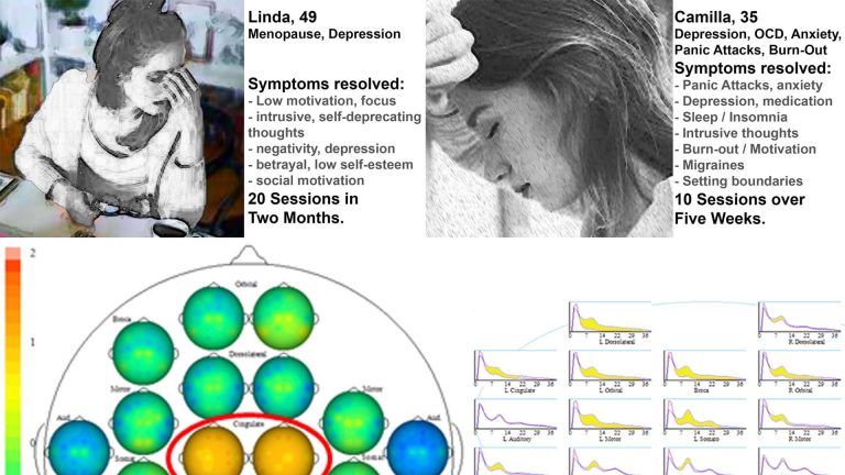Neurofeedback for depression produces lasting results, fast, with scientific evidence.