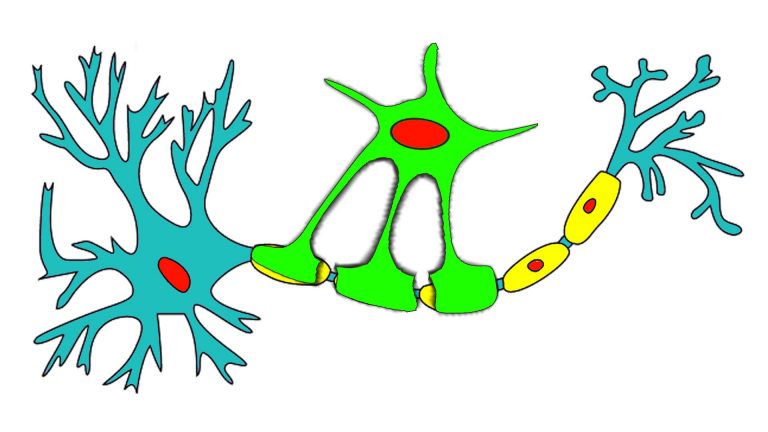 Multiple Sclerosis (MS) is a function of oligodendrocyte demise, leading to demyelination of neuronal axons, a process that can be addressed with neurofeedback