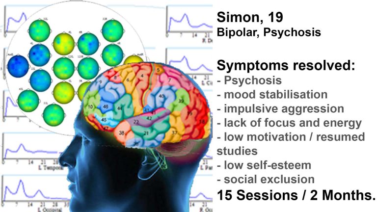 Two months of neurofeedback training transformed Simon from apathy to participation while reducing psychotropic medication