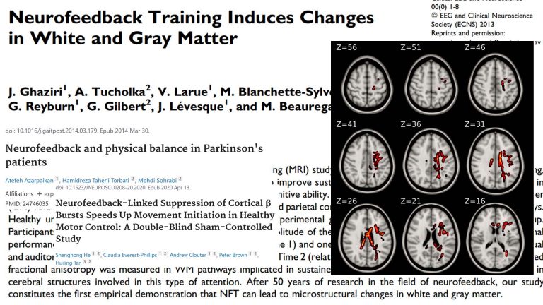 Ghaziri 2013 study showing that neurofeedback has positive structural impact improving myelination