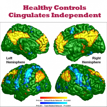 healthy Controls show independent cingulates and reduced risk of psychosis