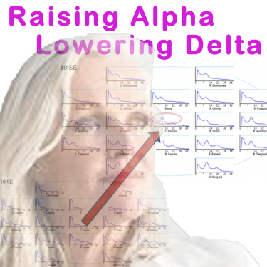 Rasising alpha while lowering delta with neurofeedback training for menopause