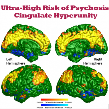 Cingulate Hyperunity indicates ultra high risk of psychosis